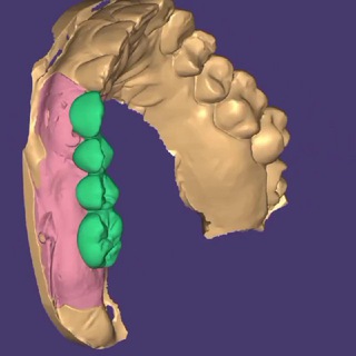 Аватар Telegram-канала Стоматология «Чулман-мед»