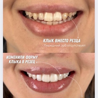 Аватар Telegram-канала СТОМАТОЛОГИЯ dr.magomadovaamina | Москва • Грозный