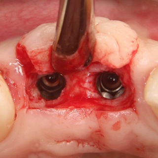 Аватар Telegram-канала Современная имплантология с Александром Муслимовым