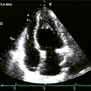 Аватар Эхокардиография/Кардиология/Echocardiography/Cardiology🫀👨‍⚕
