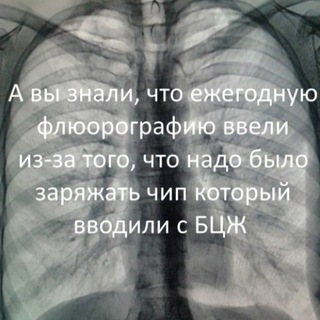 Аватар Рентгенология