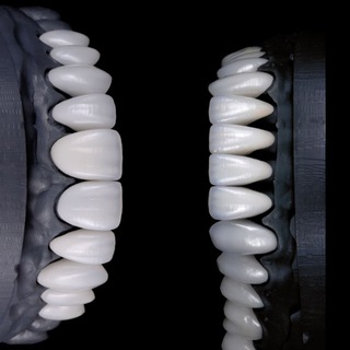 Аватар Telegram-канала ▶️𝐏𝐫𝐨𝐃вижение зубов•Эстетика улыбок•𝐏𝐫𝐨𝐒𝐦𝐢𝐥𝐞𝐬💎